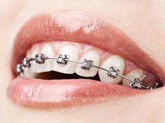 Orto-Implant Expert - Clinica Ortodontie si implantologie